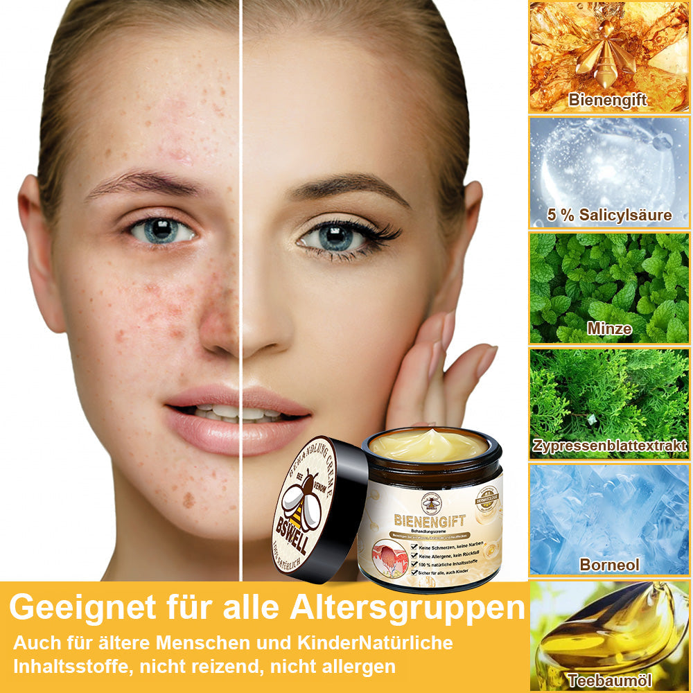 အရေပြားရောဂါကုထုံး